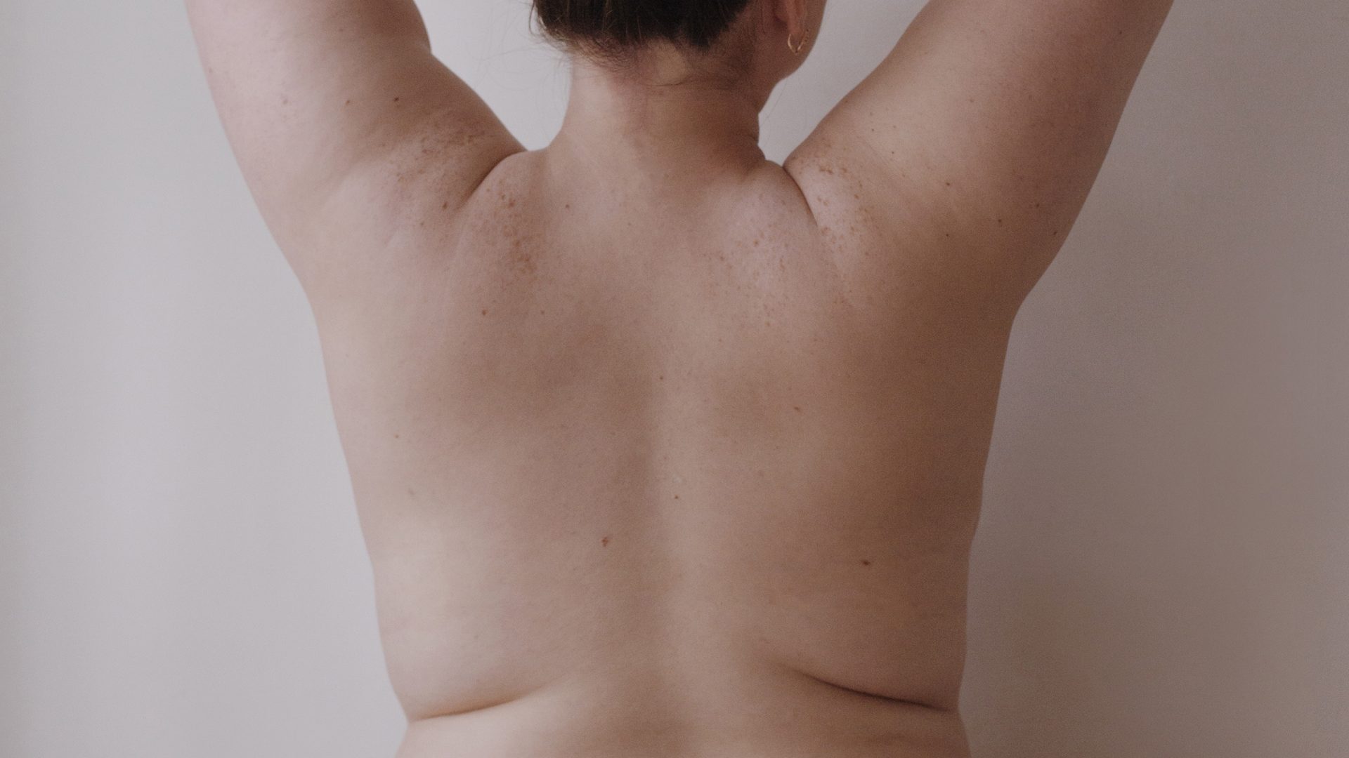 Who Is an Ideal Candidate for a Bra Line Lift