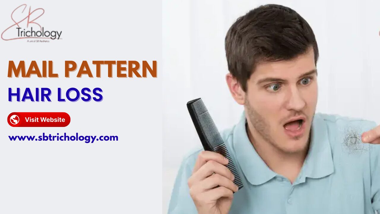 Mail Pattern Hair Loss