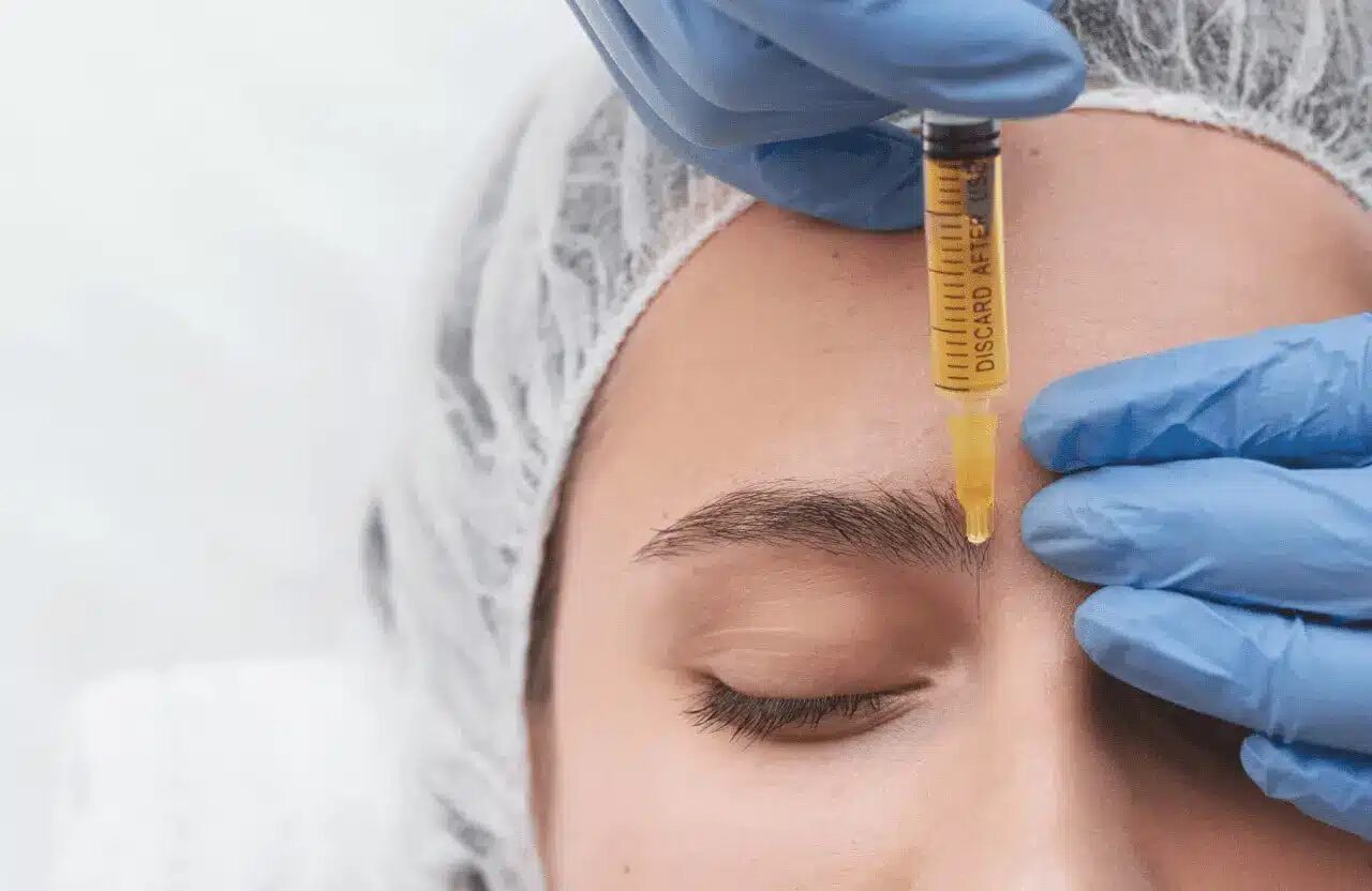 Mesotherapy for Hair Loss Everything You Should Know