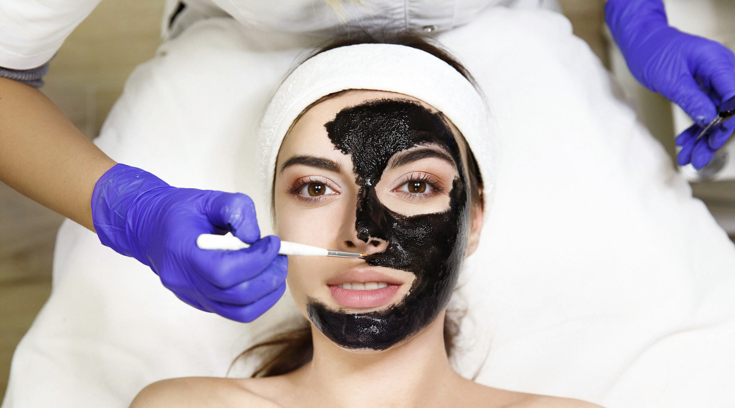 Say Goodbye to Dull Skin With Laser Carbon Peel