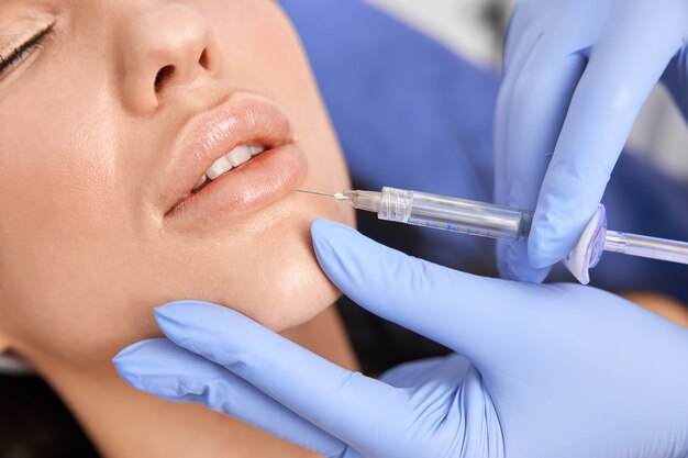 u3700-10-Things-First-Timers-Should-Know-Before-Getting-Lip-Fillers-in-Dubai