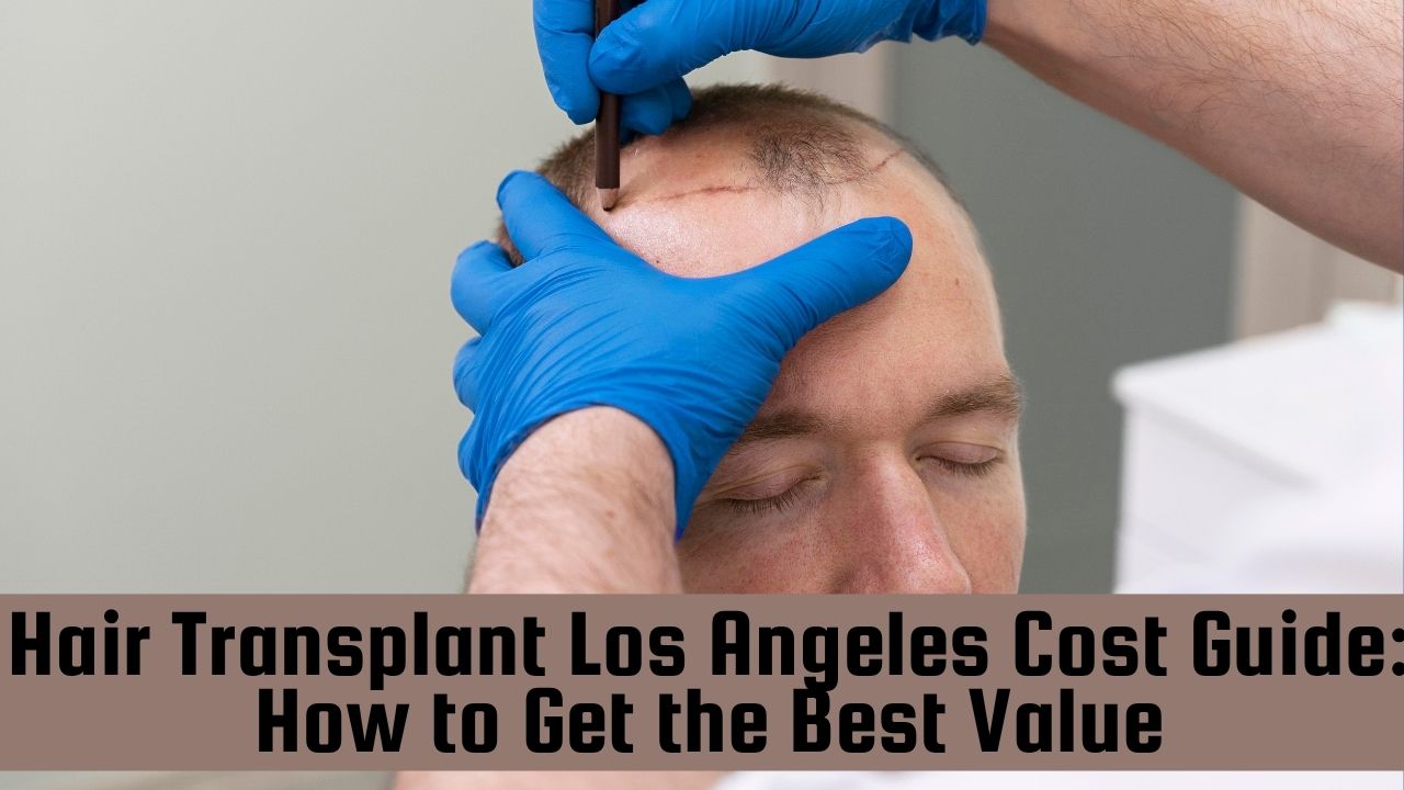 u3787-The-Ultimate-Guide-to-FUE-Hair-Transplant-Los-Angeles-4