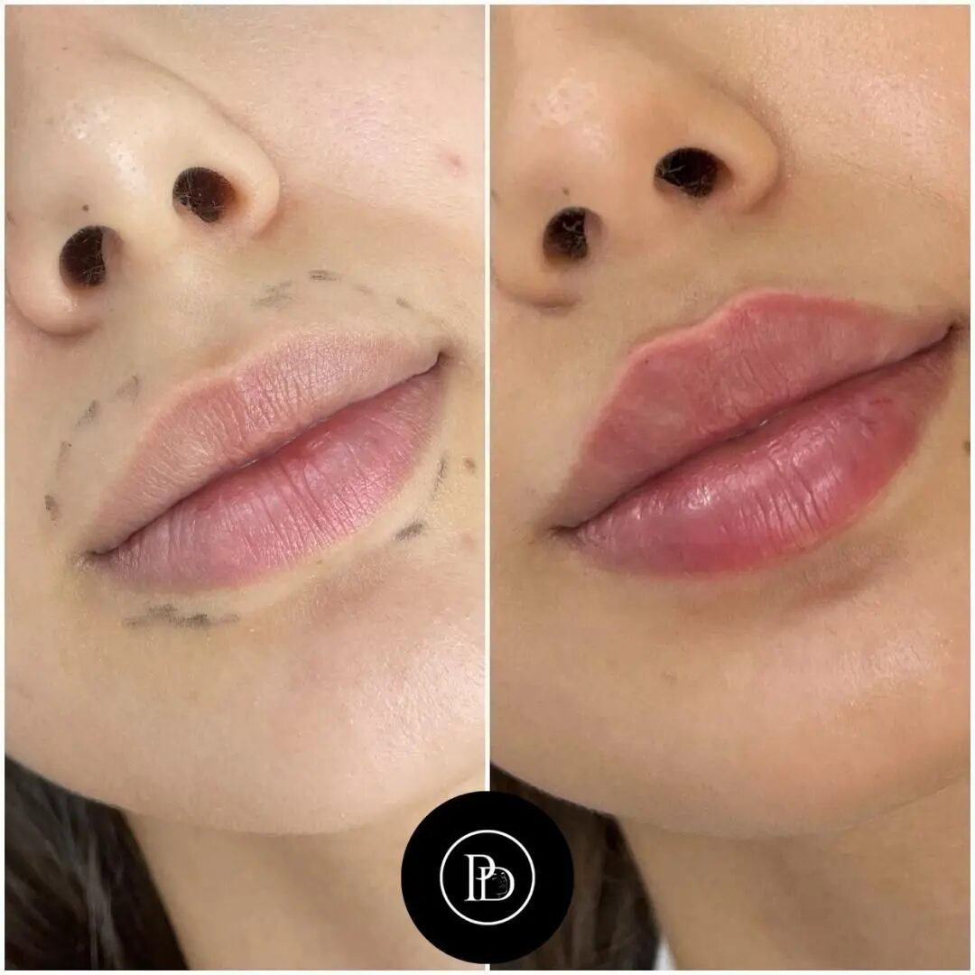 299929520_464164238952489_969614888516111728_n