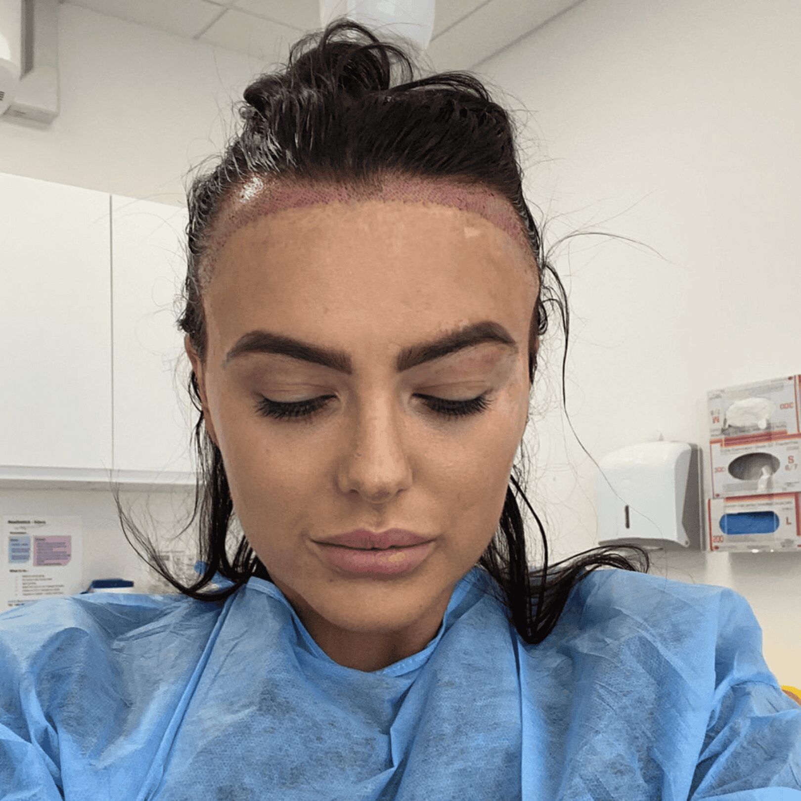 u3718-Skilled-Specialists-Delivering-Quality-Care-Hair-Transplant-in-Dubai