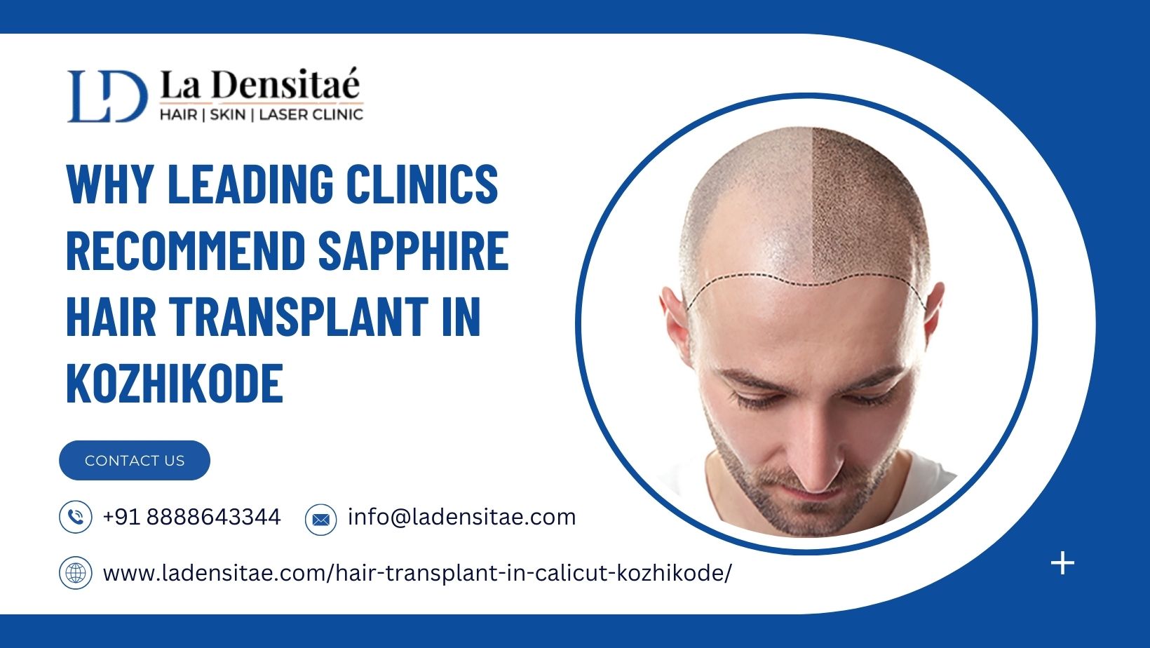 Why-Leading-Clinics-Recommend-Sapphire-Hair-Transplant-in-Kozhikode