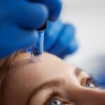 Skinpen-Microneedling-in-Altrincham