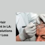 Best-Hair-Transplant-in-LA-Modern-Solutions-for-Hair-Loss