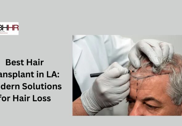 Best-Hair-Transplant-in-LA-Modern-Solutions-for-Hair-Loss