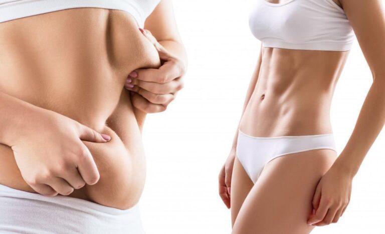 Fat-Transfer-Doctors-in-Dubai