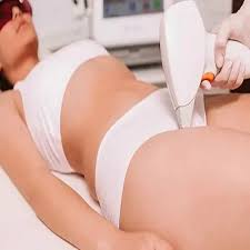 Non-surgical-Vaginal-Rejuvenation-Dubai