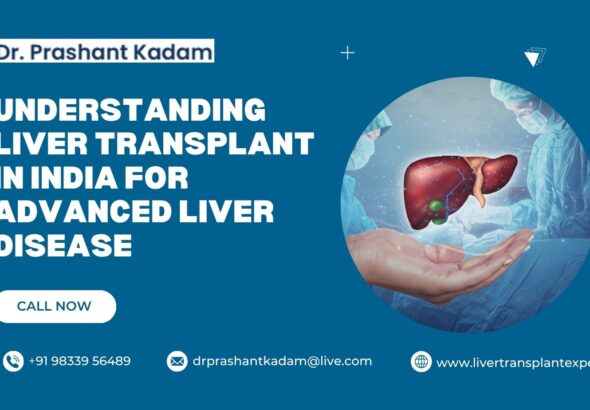 Understanding-Liver-Transplant-in-India-for-Advanced-Liver-Disease