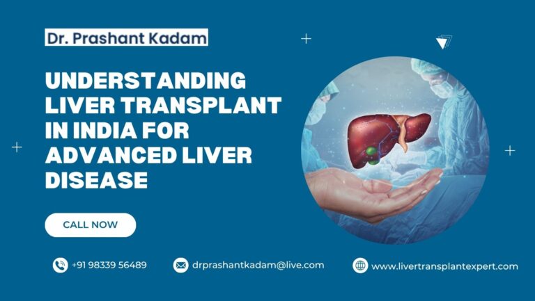 Understanding-Liver-Transplant-in-India-for-Advanced-Liver-Disease