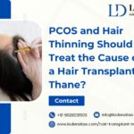 PCOS-and-Hair-Thinning-—-Should-You-Treat-the-Cause-or-Get-a-Hair-Transplant-in-Thane