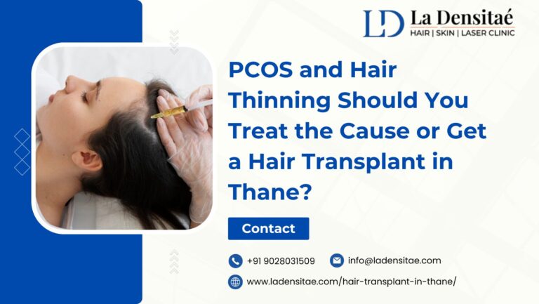 PCOS-and-Hair-Thinning-—-Should-You-Treat-the-Cause-or-Get-a-Hair-Transplant-in-Thane